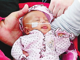 出生僅半斤全球“最小嬰兒”出院